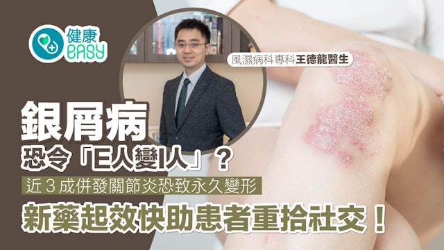香港01王德龍醫生銀屑病關節炎報導